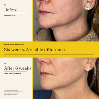 DermaReverse Pre-Order
